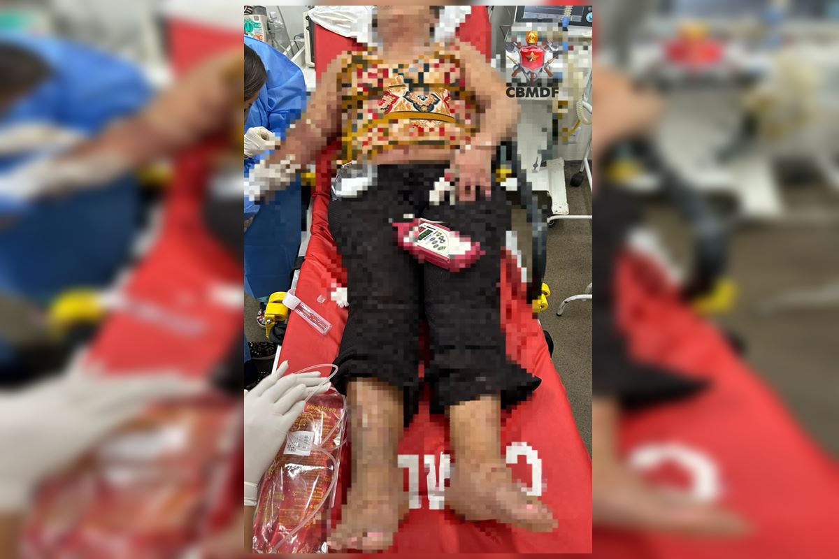Mulher é hospitalizada após sofrer ataque de enxame de abelhas na rua